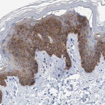 Immunohistochemistry-Paraffin: Cytokeratin 14 Antibody [NBP1-84917]