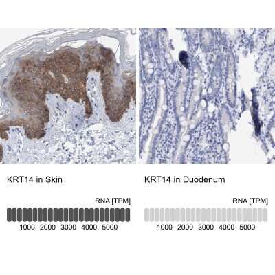 Immunohistochemistry-Paraffin: Cytokeratin 14 Antibody [NBP1-84917]