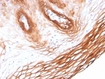 Immunohistochemistry-Paraffin: Cytokeratin 14 Antibody (KRT14/2375) - Azide and BSA Free [NBP3-08531]