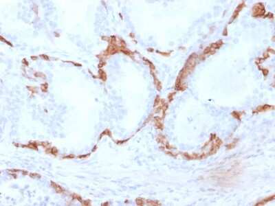Immunohistochemistry-Paraffin: Cytokeratin 14 Antibody (KRT14/2375) - Azide and BSA Free [NBP3-08531]
