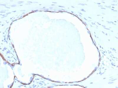 Immunohistochemistry-Paraffin: Cytokeratin 14 Antibody (KRT14/4132) [NBP3-07849]