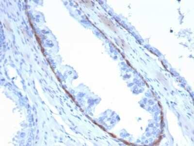 Immunohistochemistry-Paraffin: Cytokeratin 14 Antibody (KRT14/4132) - Azide and BSA Free [NBP3-08289]