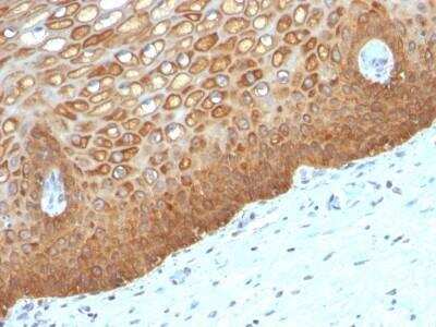 Immunohistochemistry-Paraffin: Cytokeratin 14 Antibody (KRT14/532) - Azide and BSA Free [NBP2-47720]