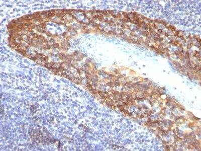 Immunohistochemistry-Paraffin: Cytokeratin 14 Antibody (KRT14/532) - IHC-Prediluted [NBP2-48042]