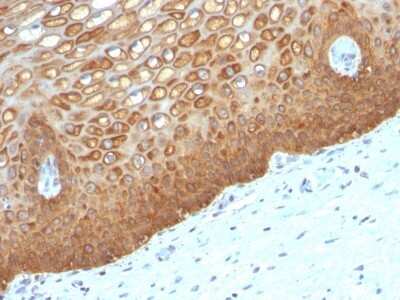Immunohistochemistry-Paraffin: Cytokeratin 14 Antibody (KRT14/532) [NBP2-45032]