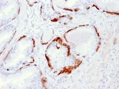Immunohistochemistry-Paraffin: Cytokeratin 14 Antibody (LL002) - Azide and BSA Free [NBP2-34675]