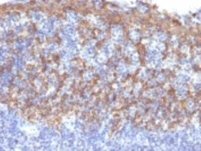 Immunohistochemistry-Paraffin: Cytokeratin 14 Antibody (LL002) - Azide and BSA Free [NBP2-34675]