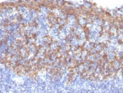 Immunohistochemistry-Paraffin: Cytokeratin 14 Antibody (LL002) [NBP2-34270]