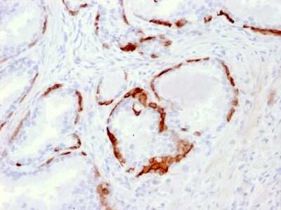 Immunohistochemistry-Paraffin: Cytokeratin 14 Antibody (LL002) [NBP2-34270]
