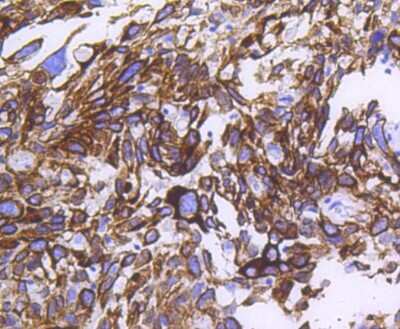 Immunohistochemistry-Paraffin: Cytokeratin 14 Antibody (SC65-06) [NBP2-67585]