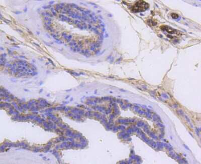 Immunohistochemistry-Paraffin: Cytokeratin 14 Antibody (SC65-06) [NBP2-67585]