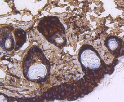 Immunohistochemistry-Paraffin: Cytokeratin 14 Antibody (SC65-06) [NBP2-67585]