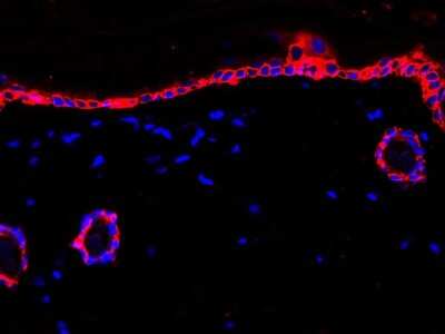 Immunohistochemistry-Paraffin: Cytokeratin 14 Antibody (SC65-06) [NBP2-67585]