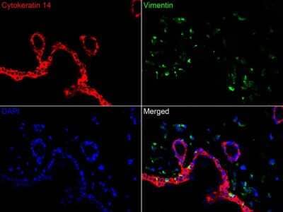 Immunohistochemistry-Paraffin: Cytokeratin 14 Antibody (SC65-06) [NBP2-67585]