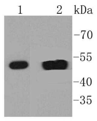 Western Blot: Cytokeratin 14 Antibody (SC65-06) [NBP2-67585]