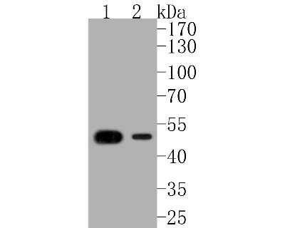 Western Blot: Cytokeratin 14 Antibody (SC65-06) [NBP2-67585]