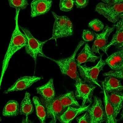 Immunocytochemistry/ Immunofluorescence: Cytokeratin 14 Antibody (SPM263) - Azide and BSA Free [NBP2-34403]