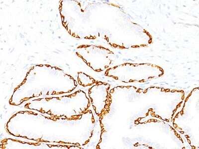 Immunohistochemistry-Paraffin: Cytokeratin 14 Antibody (SPM263) - IHC-Prediluted [NBP2-45030]
