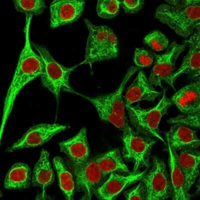 Immunocytochemistry/ Immunofluorescence: Cytokeratin 14 Antibody (SPM263) [NBP2-34355]