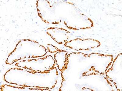 Immunohistochemistry-Paraffin: Cytokeratin 14 Antibody (SPM263) [NBP2-34355]