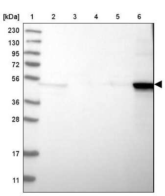 Western Blot: Cytokeratin 14 Antibody [NBP1-84917]