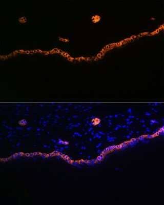 Immunohistochemistry: Cytokeratin 15 Antibody (9F9F0) [NBP3-16492]