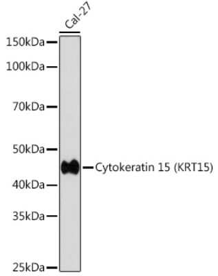 Western Blot: Cytokeratin 15 Antibody (9F9F0) [NBP3-16492]