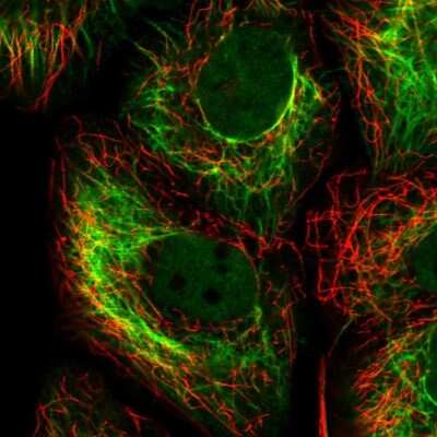 Immunocytochemistry/ Immunofluorescence: Cytokeratin 15 Antibody [NBP1-85602]