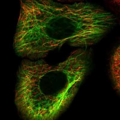Immunocytochemistry/ Immunofluorescence: Cytokeratin 15 Antibody [NBP1-85603]