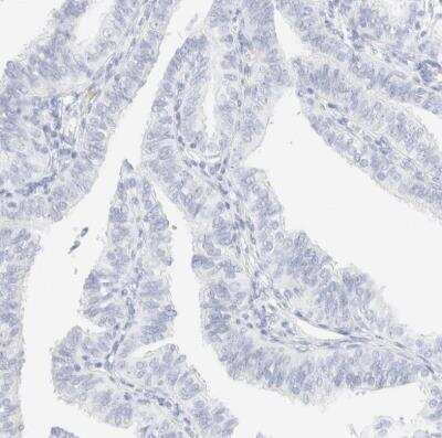 Immunohistochemistry-Paraffin: Cytokeratin 15 Antibody [NBP1-85602]