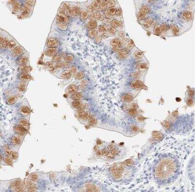 Immunohistochemistry-Paraffin: Cytokeratin 15 Antibody [NBP1-85602]