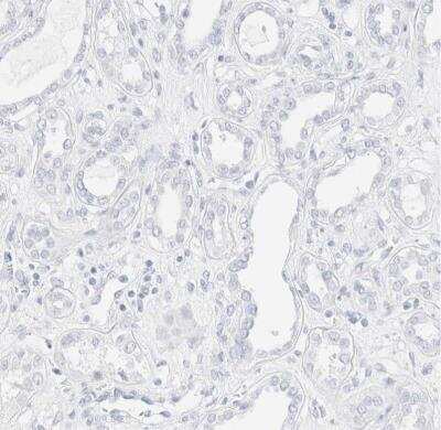 Immunohistochemistry-Paraffin: Cytokeratin 15 Antibody [NBP1-85602]