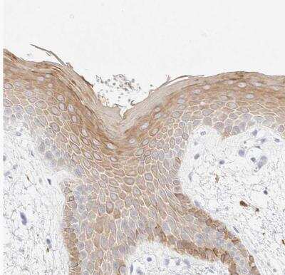 Immunohistochemistry-Paraffin: Cytokeratin 15 Antibody [NBP1-85602]