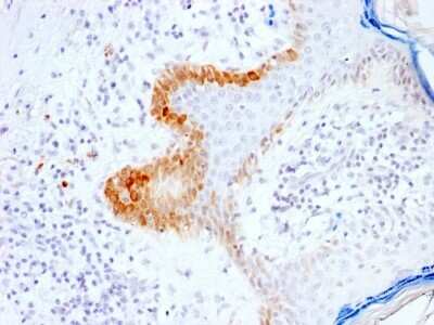 Immunohistochemistry-Paraffin: Cytokeratin 15 Antibody (KRT15/2103R) - Azide and BSA Free [NBP3-08609]