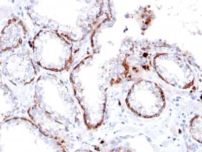 Immunohistochemistry-Paraffin: Cytokeratin 15 Antibody (KRT15/2103R) - Azide and BSA Free [NBP3-08609]