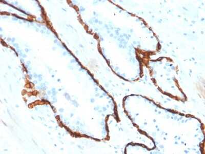 Immunohistochemistry-Paraffin: Cytokeratin 15 Antibody (KRT15/2554) [NBP3-07612]