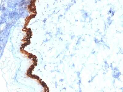 Immunohistochemistry-Paraffin: Cytokeratin 15 Antibody (KRT15/2554) [NBP3-07612]