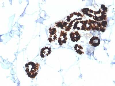 Immunohistochemistry-Paraffin: Cytokeratin 15 Antibody (KRT15/2554) - Azide and BSA Free [NBP3-08562]