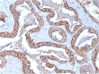 Immunohistochemistry-Paraffin: Cytokeratin 15 Antibody (KRT15/2957) - Azide and BSA Free [NBP3-08478]