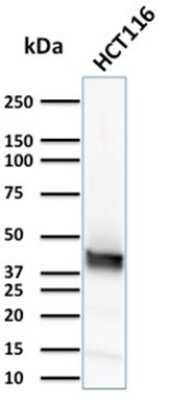 Western Blot: Cytokeratin 15 Antibody (KRT15/2957)Azide and BSA Free [NBP3-08478]