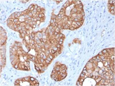 Immunohistochemistry-Paraffin: Cytokeratin 15 Antibody (KRT15/2957) [NBP3-07613]