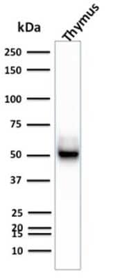 Western Blot: Cytokeratin 15 Antibody (KRT15/2957) [NBP3-07613]