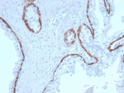 Immunohistochemistry-Paraffin: Cytokeratin 15 Antibody (KRT15/2958) [NBP3-07614]