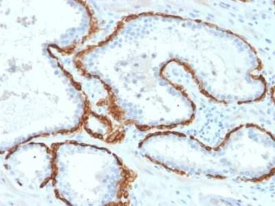Immunohistochemistry-Paraffin: Cytokeratin 15 Antibody (KRT15/2958) - Azide and BSA Free [NBP3-08569]