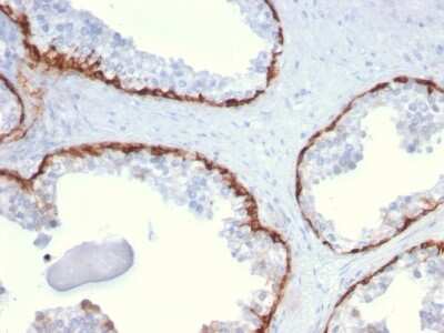 Immunohistochemistry-Paraffin: Cytokeratin 15 Antibody (KRT15/2959) - Azide and BSA Free [NBP3-08599]