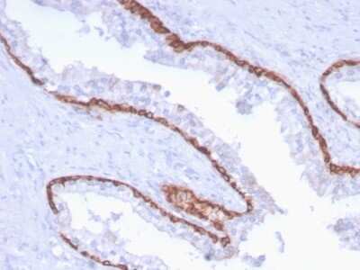 Immunohistochemistry-Paraffin: Cytokeratin 15 Antibody (KRT15/2959) - Azide and BSA Free [NBP3-08599]