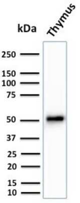 Western Blot: Cytokeratin 15 Antibody (KRT15/2959)Azide and BSA Free [NBP3-08599]