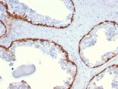 Immunohistochemistry-Paraffin: Cytokeratin 15 Antibody (KRT15/2959) [NBP3-07620]
