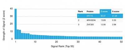 Protein Array: Cytokeratin 15 Antibody (KRT15/2959) [NBP3-07620]