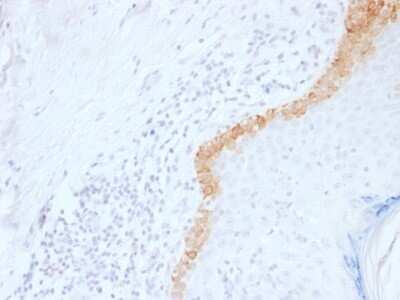 Immunohistochemistry-Paraffin: Cytokeratin 15 Antibody (LHK15) - Azide and BSA Free [NBP2-54462]